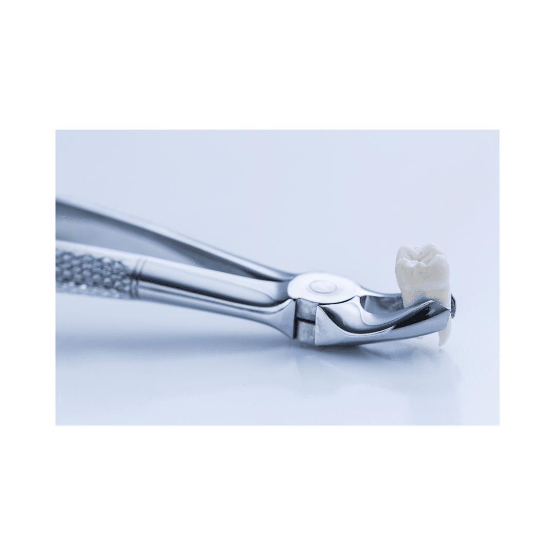 Services Tooth extraction